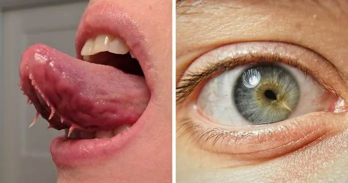 30 People Whose Genetics Made Them Unique