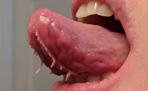 30 People Whose Genetics Made Them Unique