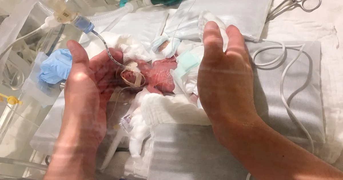 Tras pasar meses en el hospital, el bebé prematuro superviviente más pequeño del mundo al fin ha recibido el alta