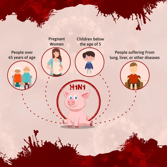 Swine Flu Is Here: Are We Ready To Fight It?