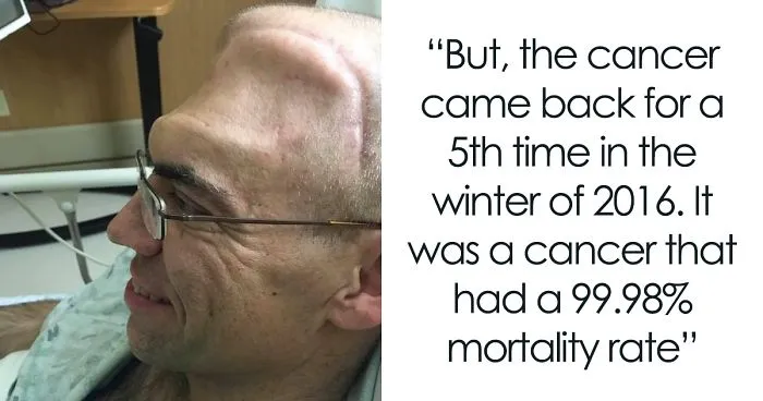 Guy Who Was Supposed To Live For 6 Years After Brain Cancer Diagnosis, Lives For 20+ Years, Beats It 4 Times
