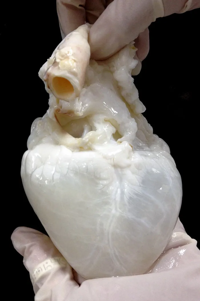 Corazón "limpio"
