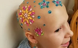 30 People With Illnesses And Disabilities Overshining Their Hardships With Humor