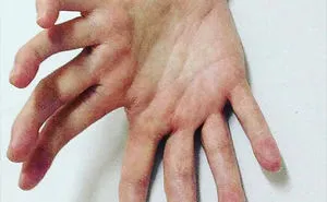 30 People Whose Genetics Made Them Unique