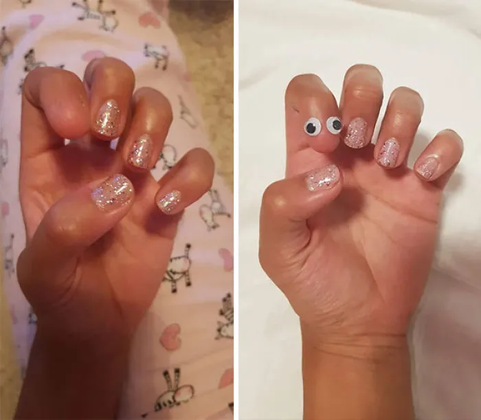 Mi novia nació sin uña en el dedo índice. Por demanda popular, le hemos puesto ojos saltones
