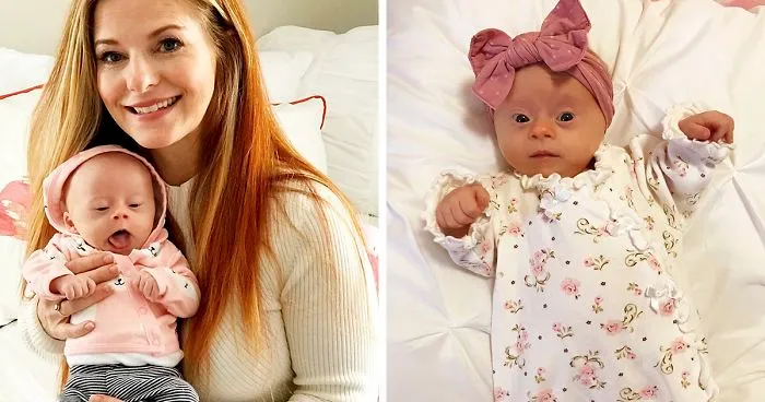 Mom Shares Honest 'Review' Of Her Baby With Down Syndrome, And 347K People Love It