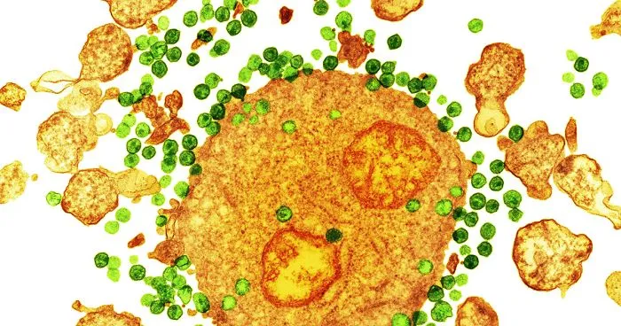 Second Patient In History Has Been Cured Of HIV