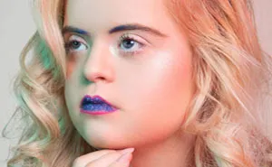 ‘The Radical Beauty Project’ Challenges The Way We See People With Down’s Syndrome By Showing Their Modeling Skills (Zebedee Management)