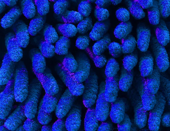 Coral Reefs Or Broccoli?