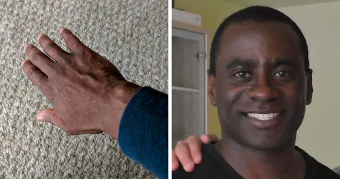 Putting A Bandage That Blends In With His Skin Has Brought Up An Emotional Reaction From This Man