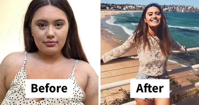 Woman Reveals Before-And-After Pictures Of Her 141-Pound Weight Loss, And She's Completely Transparent About It