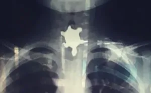 30 Dumbest Ways People Managed To Get Injured