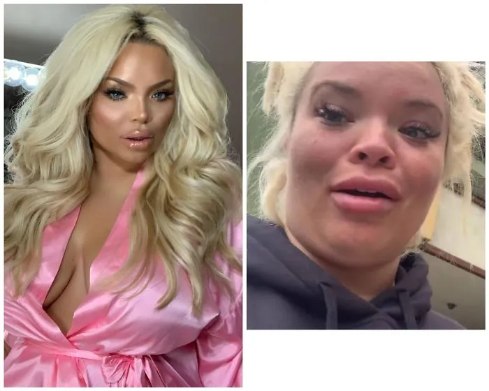 Yeah Looks Legit (It Was Days Apart Btw So No Sudden Weight Gain Or A Horrendous Accident Or Anything Lol Just Constant Facetuning)