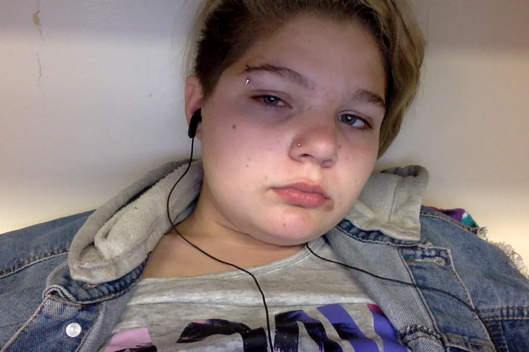 Days With Dealing With An Infected Eye