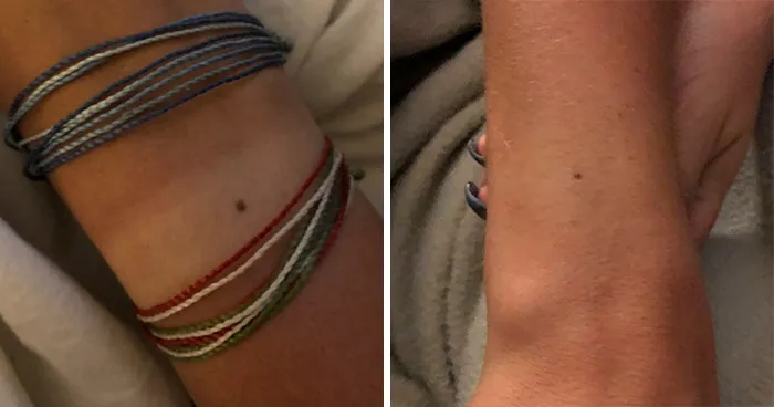 Someone Claims All Women Have A Freckle In The Middle Of Their Wrists, And People Start Freaking Out (23 Pics)