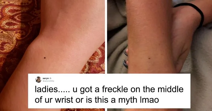 Someone Claims All Women Have A Freckle In The Middle Of Their Wrists, And People Start Freaking Out (23 Pics)