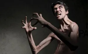 This Man Has A Rare Genetic Condition Which Made Him One Of The Most Sought After Actors In Horror