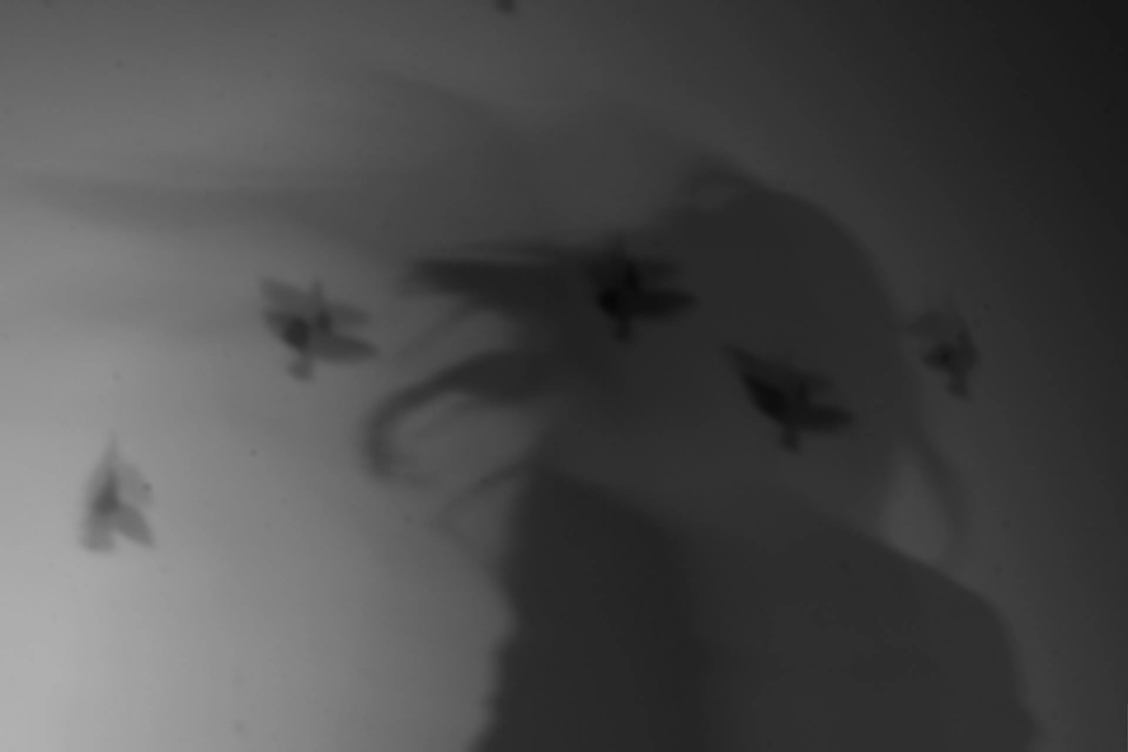 Through The Eyes Of Someone With Functional Neurological Disorder