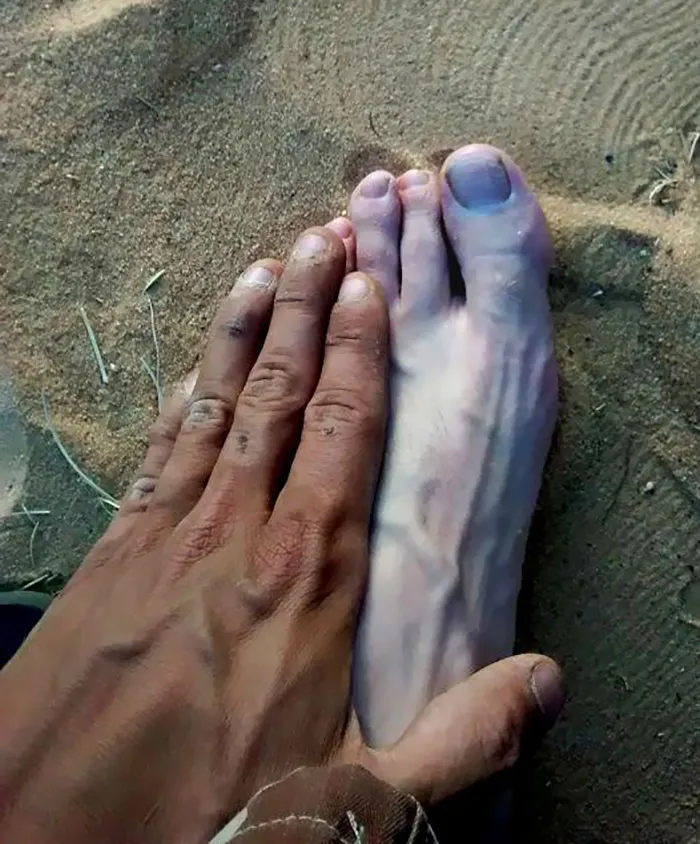 The Tan Of My Hand Compared To My Foot