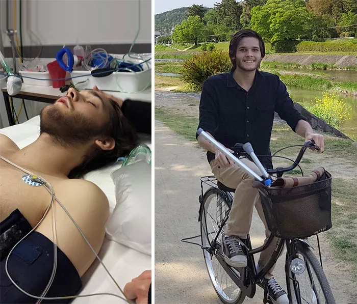 30 Suicide Survivors Share How Happy They Finally Are