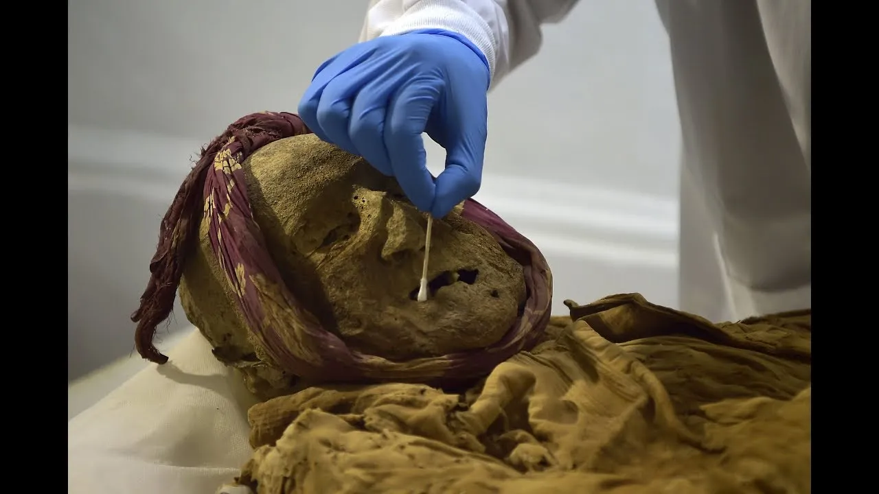 Scientists Hope They Can Cure Arthritis By Studying The Diseased Remains Of A Mummified Body