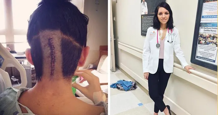After Surviving 6 Major Brain Surgeries, This Woman Is Aiming To Become A Doctor