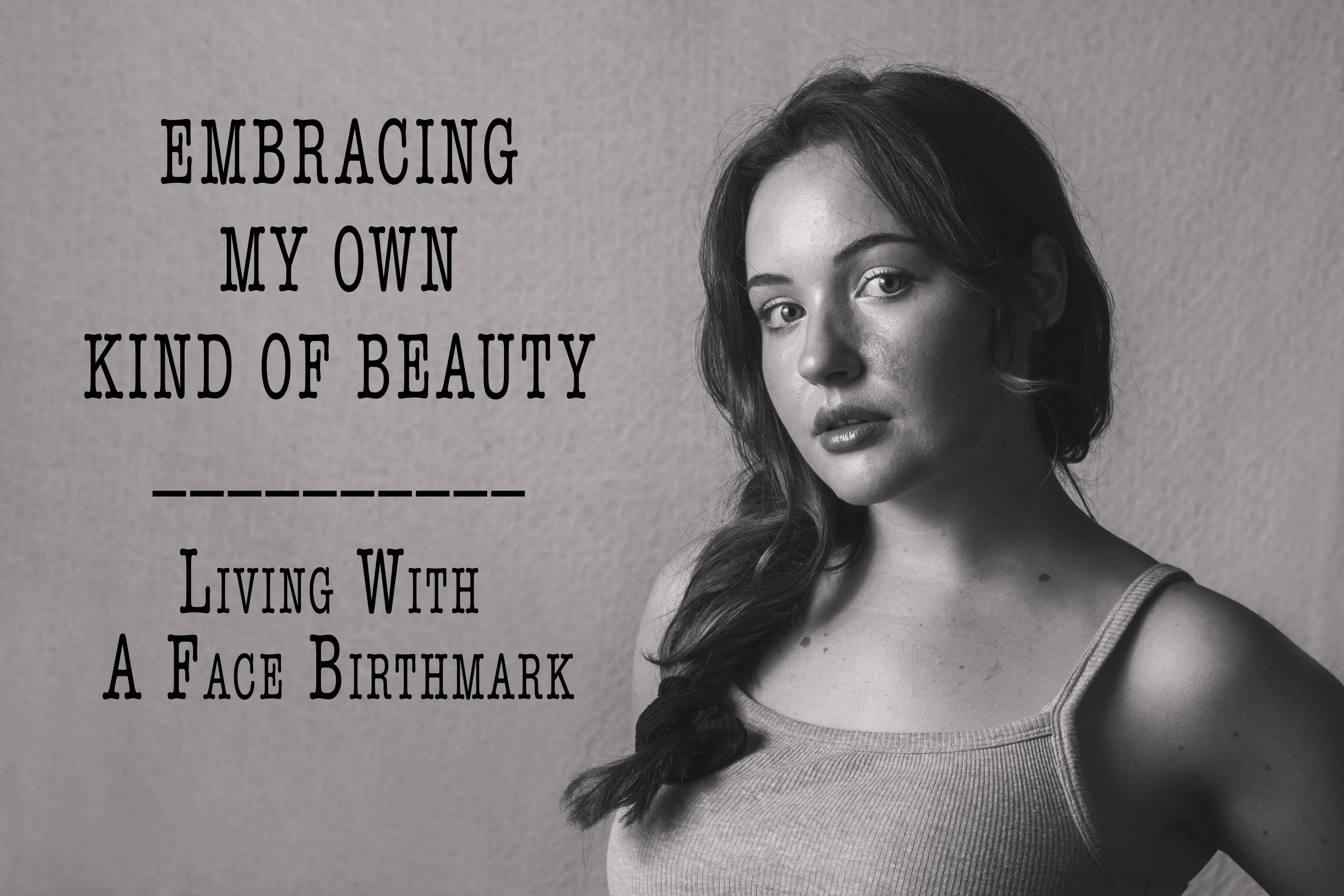 I Photographed A Woman Embracing Her Birthmark As She Defines Her Own Beauty