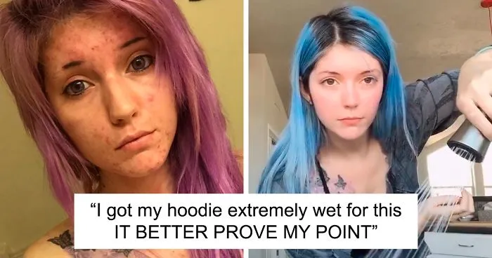People Call This 25-Year-Old A Liar Because Of How Well She Cured Her Acne, So She Posts A Video To Prove It