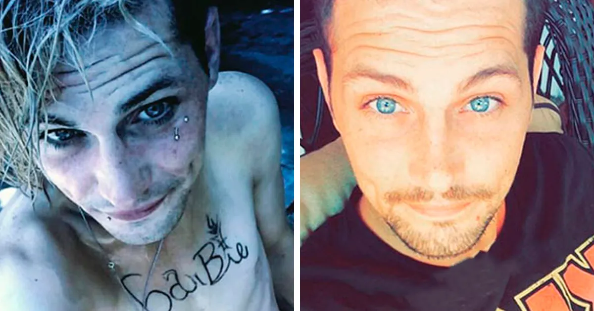 30 Impresionantes transformaciones de gente que dejó las drogas (Nuevas imágenes)