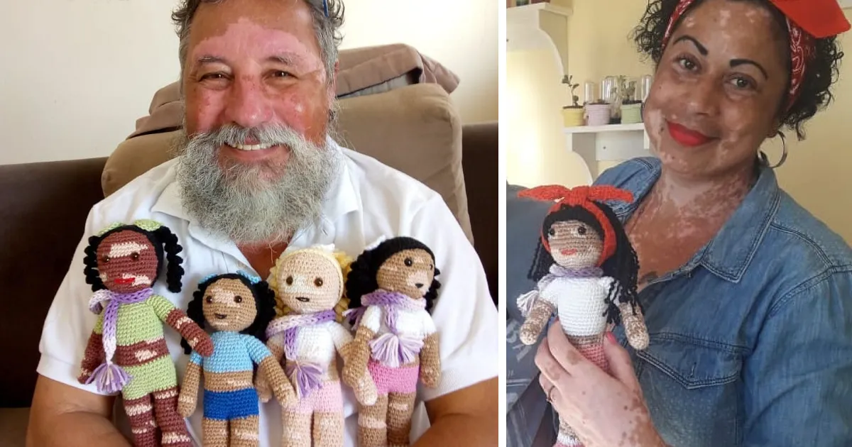 Este abuelo con vitiligo teje muñecas de ganchillo para que los niños con este problema se sientan mejor