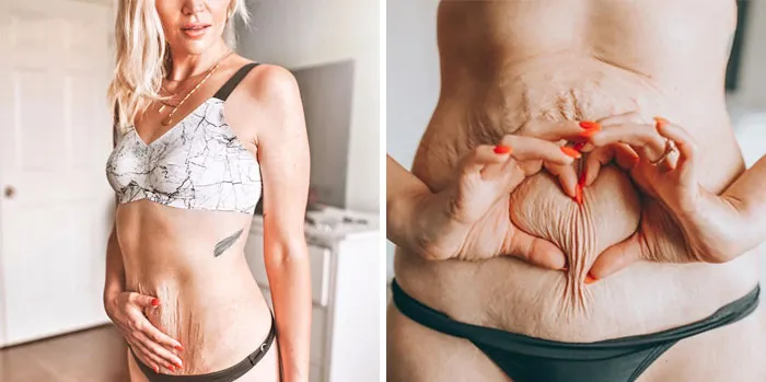 This Account Showcases Real Women That Don't Follow Society's Expectations (30 Pics)