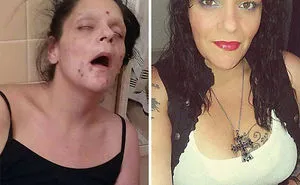 38 Stunning Before & After Transformations Of People Who Quit Drugs