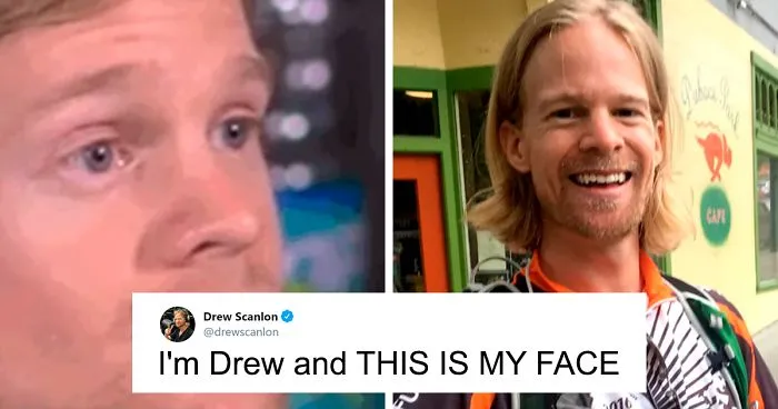 People Are Admiring The Man Known As The ‘Blinking White Guy’ Over Using His Fame To Raise Money For Charity
