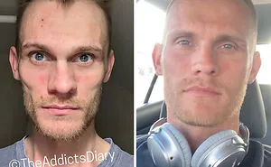 38 Stunning Before & After Transformations Of People Who Quit Drugs