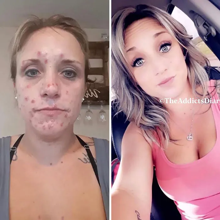 We Do Recover