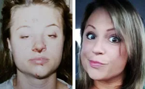 38 Stunning Before & After Transformations Of People Who Quit Drugs