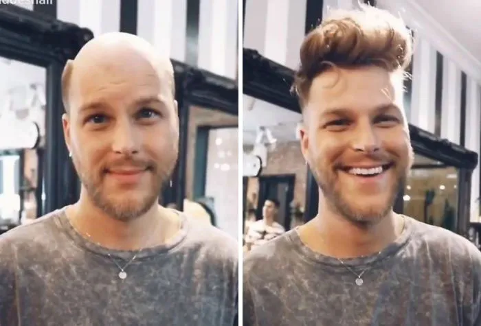 Balding Guys Try Out Non-Surgical Hair Replacements By Phil Ring, And Their Smiles Say Everything (44 Pics)