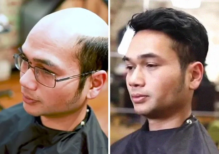 Balding Guys Try Out Non-Surgical Hair Replacements By Phil Ring, And Their Smiles Say Everything (44 Pics)