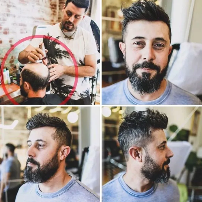 Balding Guys Try Out Non-Surgical Hair Replacements By Phil Ring, And Their Smiles Say Everything (44 Pics)