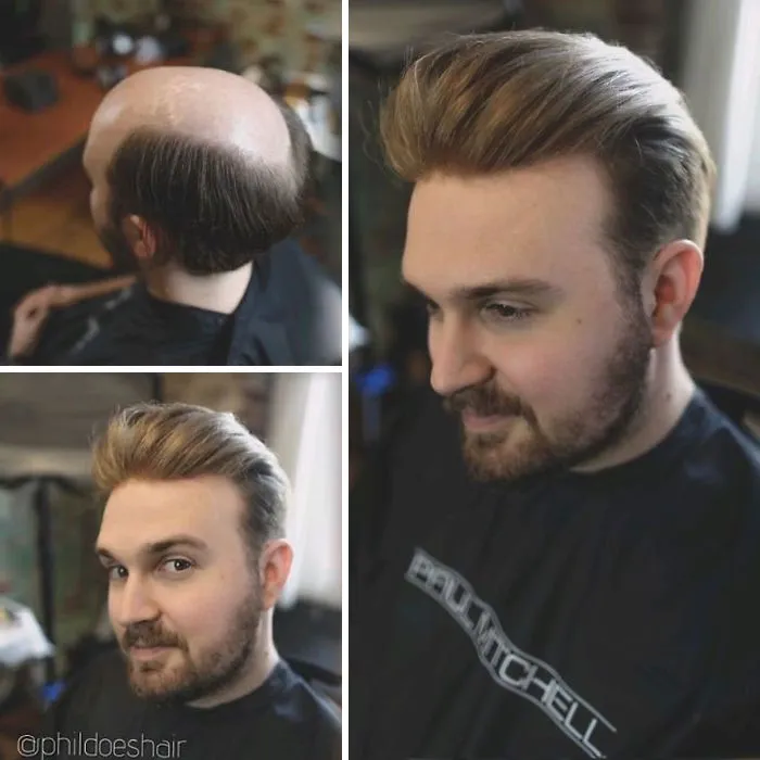 Balding Guys Try Out Non-Surgical Hair Replacements By Phil Ring, And Their Smiles Say Everything (44 Pics)