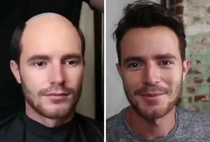 Balding Guys Try Out Non-Surgical Hair Replacements By Phil Ring, And Their Smiles Say Everything (44 Pics)
