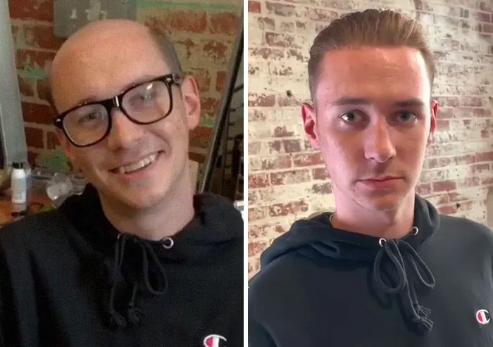 Balding Guys Try Out Non-Surgical Hair Replacements By Phil Ring, And Their Smiles Say Everything (44 Pics)
