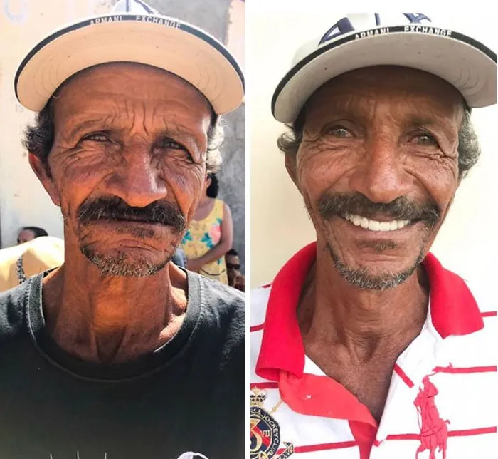 Un Dentista De Brasil Viaja Para Arreglar Gratis La Dentadura De Los Pobres