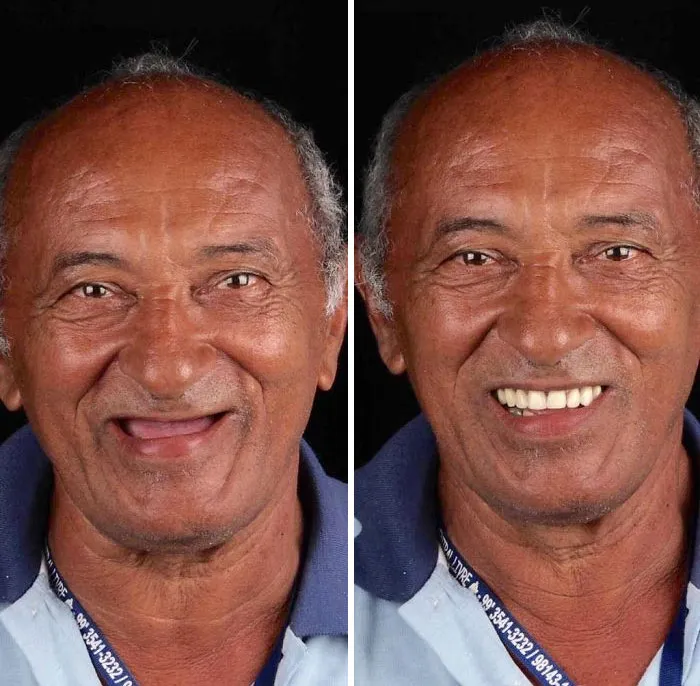 Un Dentista De Brasil Viaja Para Arreglar Gratis La Dentadura De Los Pobres