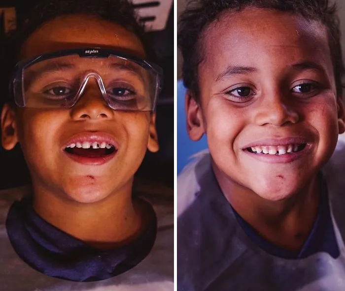 Brazilian Dentist Travels To Treat The Teeth Of Poor People For Free And Here Are 30 Transformations