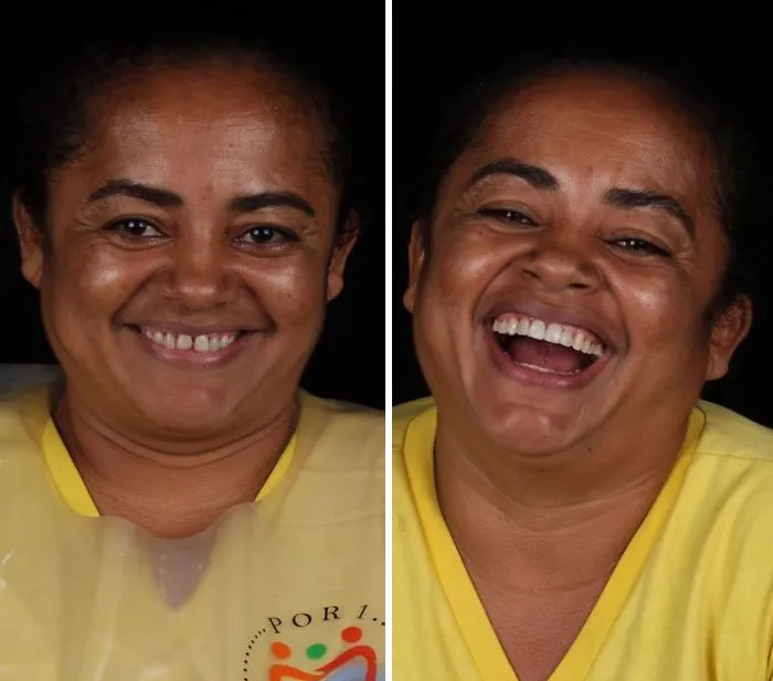 Un Dentista De Brasil Viaja Para Arreglar Gratis La Dentadura De Los Pobres