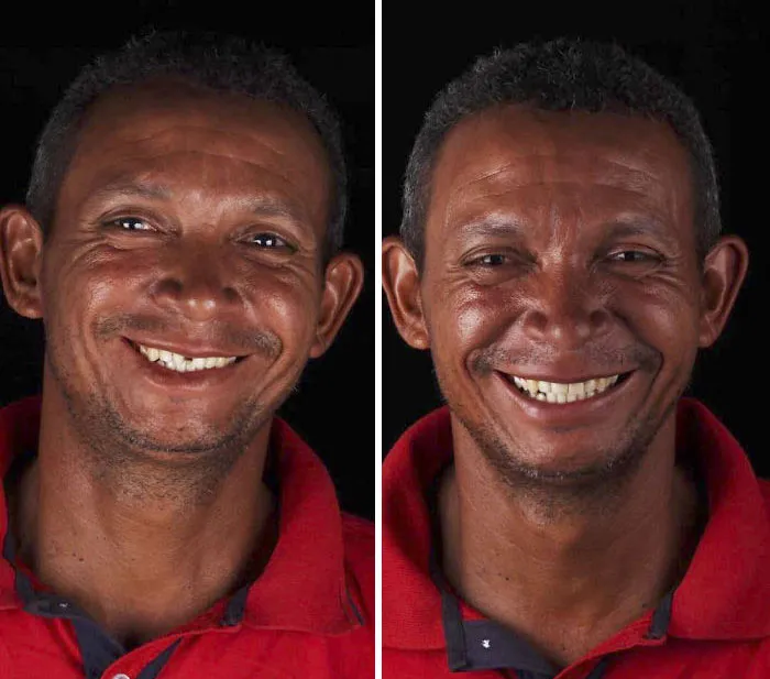 Brazilian Dentist Travels To Treat The Teeth Of Poor People For Free And Here Are 30 Transformations