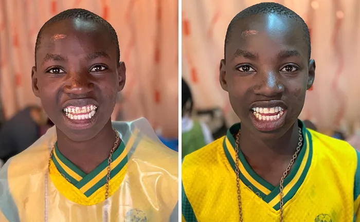 Brazilian Dentist Travels To Treat The Teeth Of Poor People For Free And Here Are 30 Transformations