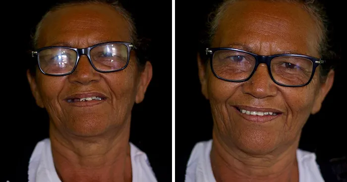 Brazilian Dentist Travels To Treat The Teeth Of Poor People For Free And Here Are 30 Transformations