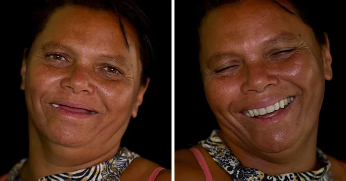 Un Dentista De Brasil Viaja Para Arreglar Gratis La Dentadura De Los Pobres